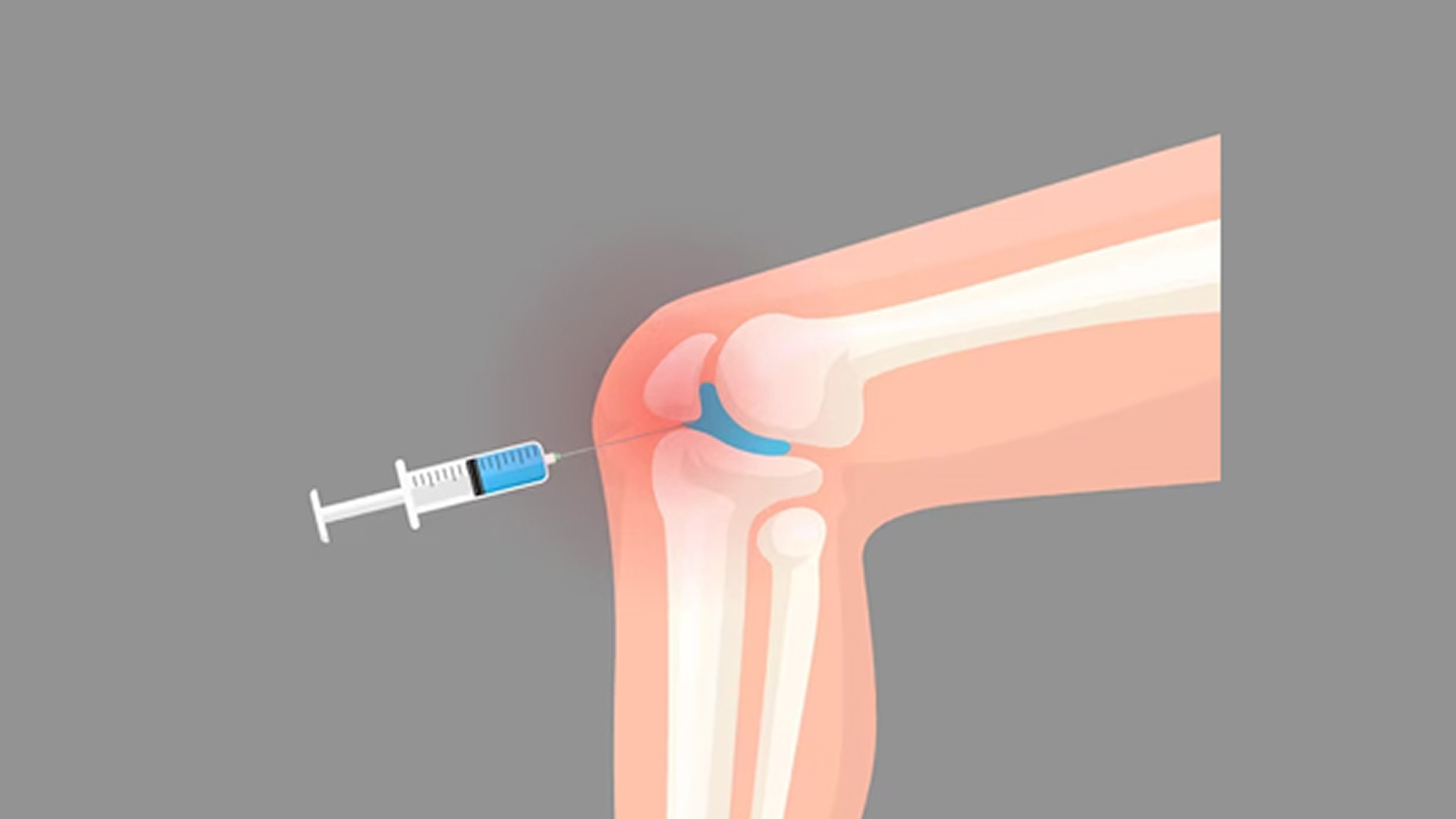Orthopedic Surgeon in Pitampura